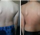 Уникальная фотография Массаж Уникальный оздоравливающий массаж по методу BFM 4223284 в Москве Изображение в Красота и здоровье Массаж Предлагаю уникальный оздоравливающий массаж в Москве 750